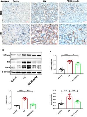 Natural Flavonoid Pectolinarigenin Alleviated Hyperuricemic Nephropathy via Suppressing TGFβ/SMAD3 and JAK2/STAT3 Signaling Pathways